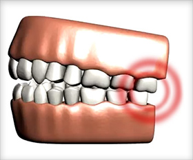 toothache relief and tooth pain help in Orem and Provo