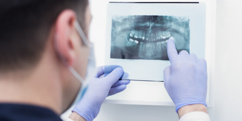Male doctor holding and looking at dental x-ray, root canal