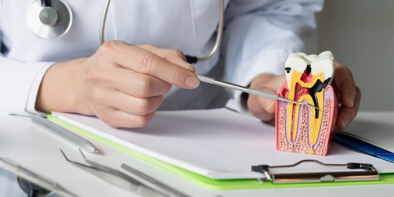 The dentist shows the disease and the formation of the tooth pulp