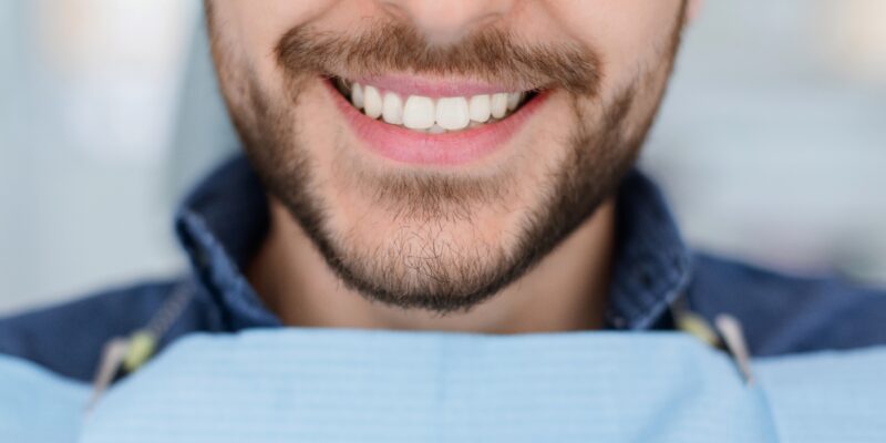 Closeup of man dental clinic patient white healthy smile